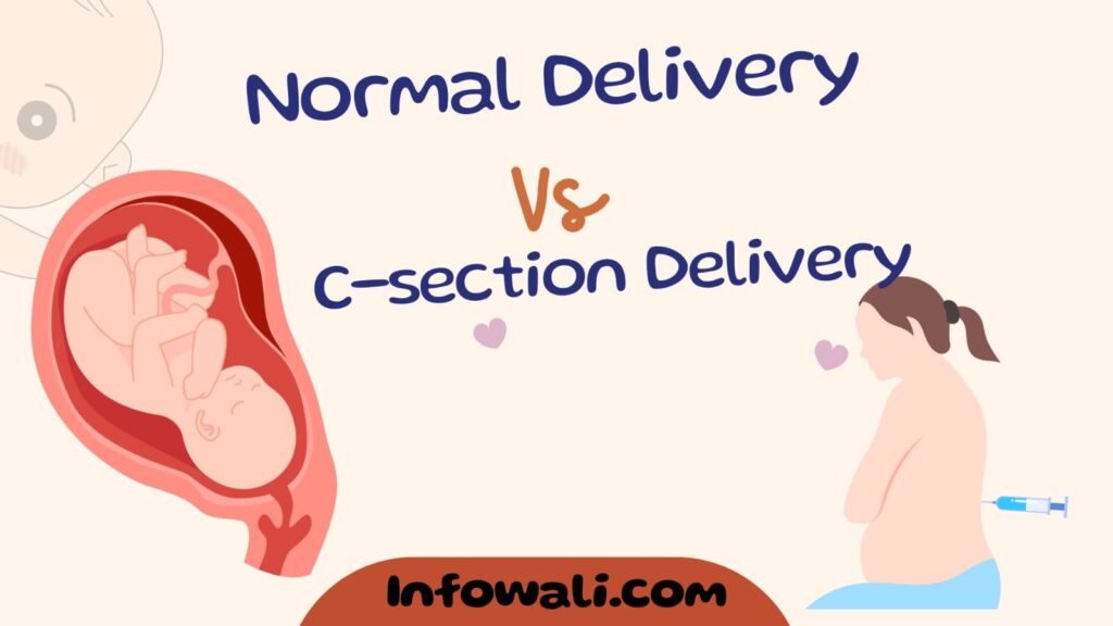 Normal Delivery vs C-Section